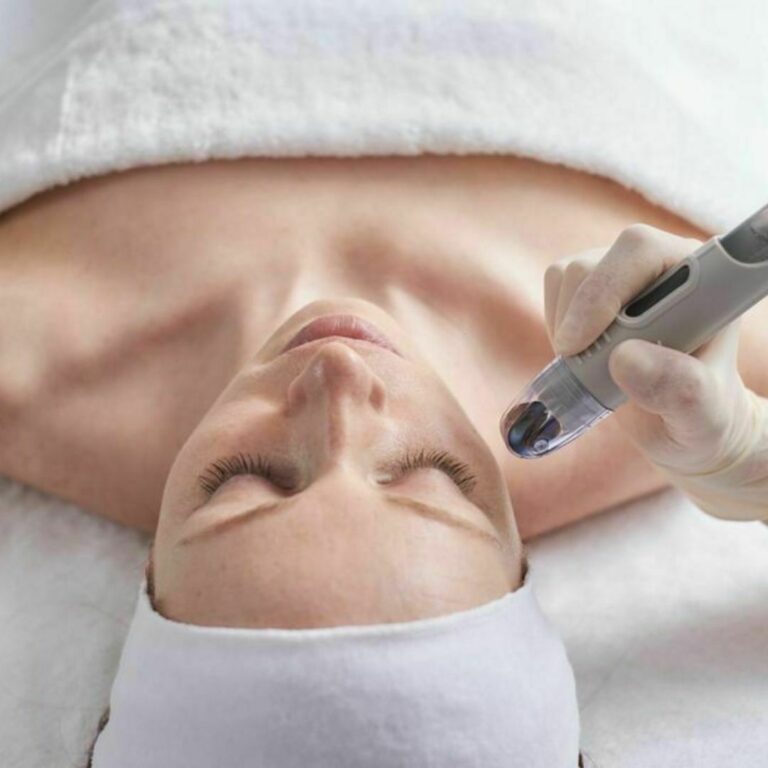 Dermafrac service